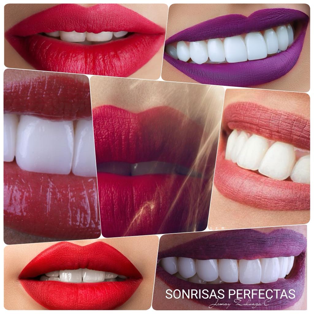 Porcelain Veneers Smile Design