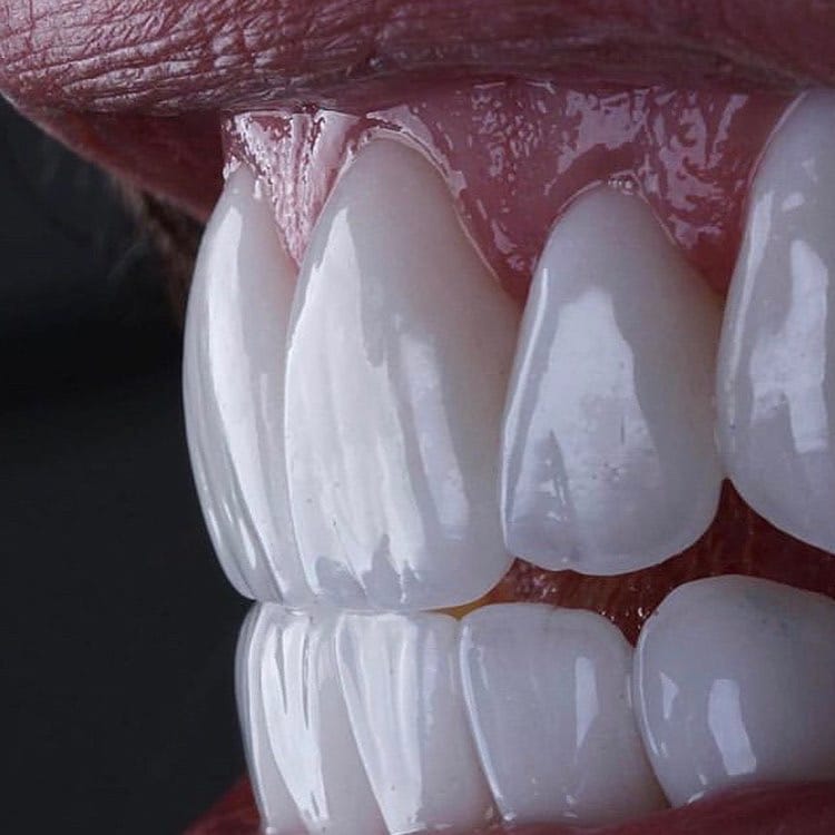 Cosmetic Dentist in Colombia